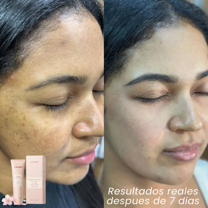 Quarxery Gel - Exfoliante Aclarador.