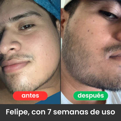 Bálsamo para Crecimiento de Barba Ultra Potente con Minoxidil 20% | 100mL